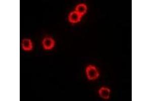 Immunofluorescent analysis of CD281 staining in Hela cells. (TLR1 抗体)