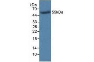 Detection of Recombinant TK1, Human using Monoclonal Antibody to Thymidine Kinase 1, Soluble (TK1) (TK1 抗体  (AA 2-234))