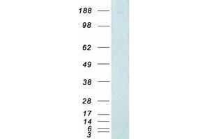 Validation with Western Blot (DAP Kinase 1 Protein (Myc-DYKDDDDK Tag))
