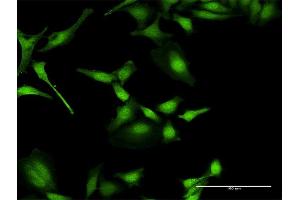 Immunofluorescence (IF) image for anti-Phosphatidylinositol-4-Phosphate 5-Kinase, Type I, alpha (PIP5K1A) (AA 1-500) antibody (ABIN948678)