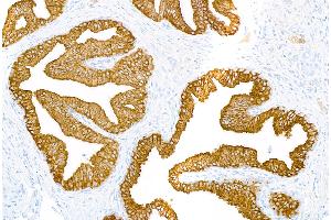 Immunohistochemistry (IHC) image for anti-Keratin 18 (KRT18) (AA 380-430) antibody (ABIN7449526)