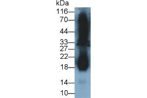 Detection of IFNg in Cavia Testis lysate using Polyclonal Antibody to Interferon Gamma (IFNg) (Interferon gamma 抗体  (AA 24-166))