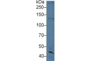 Western blot analysis of Human HeLa (10u) cell lysate, using Mouse CYTSB Antibody (5 µg/ml) and HRP-conjugated Goat Anti-Rabbit antibody ( (NSP5 抗体  (AA 961-1063))