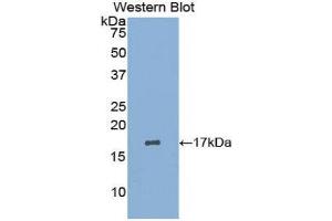 Western Blotting (WB) image for anti-Leukemia Inhibitory Factor Receptor alpha (LIFR) (AA 45-184) antibody (ABIN3208382) (LIFR 抗体  (AA 45-184))