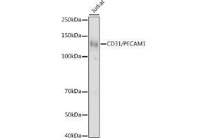 Western blot analysis of extracts of Jurkat cells, using CD31/PEC antibody (ABIN3022923, ABIN3022924, ABIN3022925 and ABIN6219299) at 1:1000 dilution. (CD31 抗体  (AA 130-230))