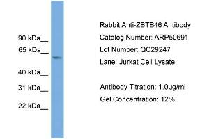 WB Suggested Anti-ZBTB46  Antibody Titration: 0. (ZBTB46 抗体  (Middle Region))