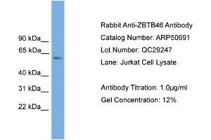WB Suggested Anti-ZBTB46  Antibody Titration: 0.