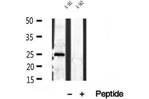Western blot analysis of extracts of K-562 cells, using PLDN antibody. (Pallidin 抗体  (C-Term))