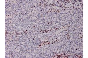 Immunohistochemistry (IHC) image for anti-Mismatch Repair Protein 2 (MSH2) (AA 327-427) antibody (ABIN6940081)