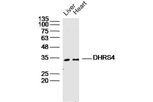 Lane 1: Mouse Liver lysates Lane 2: Mouse Heart lysates probed with DHRS4 Polyclonal Antibody, Unconjugated  at 1:300 dilution and 4˚C overnight incubation. (DHRS4 抗体  (AA 161-278))
