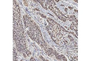 IHC analysis of hnRNP L/HNRNPL using anti-hnRNP L/HNRNPL antibody (ABIN7600130).