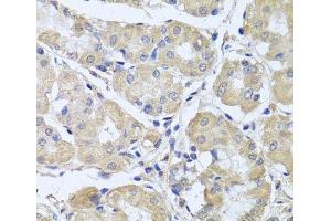 Immunohistochemistry of paraffin-embedded Human stomach using CEP57L1 Polyclonal Antibody at dilution of 1:100 (40x lens). (CEP57L1 抗体)