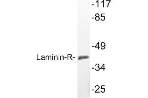 Western blot (WB) analyzes of Laminin-R antibody in extracts from K562 cells. (RPSA/Laminin Receptor 抗体)
