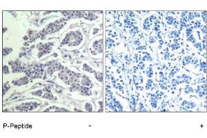 Image no. 1 for anti-V-Akt Murine Thymoma Viral Oncogene Homolog 1 (AKT1) (pTyr312), (pTyr315), (pTyr316) antibody (ABIN319269) (AKT1 抗体  (pTyr312, pTyr315, pTyr316))