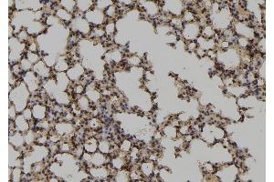 ABIN6278250 at 1/100 staining Mouse lung tissue by IHC-P. (UBE2M 抗体  (Internal Region))