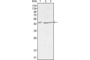 Western blot analysis using DKK3 mouse mAb against HEK293 (1), MCF-7 (2) and HL7702 (3) cell lysate. (DKK3 抗体)
