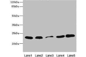 Western blot All lanes: TIMM23 antibody at 3. (TIMM23 抗体  (AA 1-209))