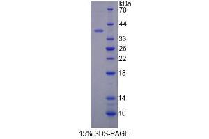 SDS-PAGE (SDS) image for Cytochrome C Oxidase Subunit VIc (COX6C) (AA 1-75) protein (His tag,GST tag) (ABIN6239477)