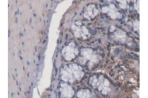 DAB staining on IHC-P; Samples: Mouse Colon Tissue (ACD 抗体  (AA 21-175))