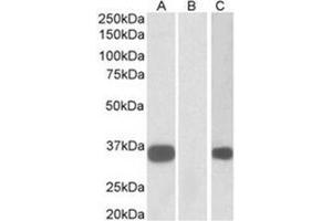 Western Blotting (WB) image for anti-Kv Channel Interacting Protein 3, Calsenilin (KCNIP3) (N-Term) antibody (ABIN1105647) (DREAM 抗体  (N-Term))