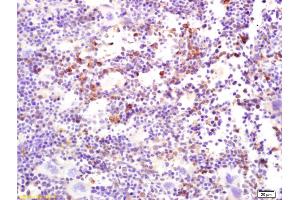 Immunohistochemistry (IHC) image for anti-C-Mer Proto-Oncogene Tyrosine Kinase (MERTK) (AA 501-600) antibody (ABIN669966)