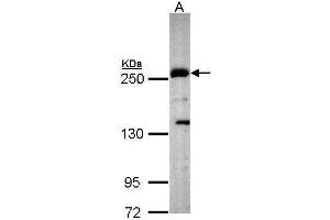 WB Image Sample (30 ug of whole cell lysate) A: Hep G2 , 5% SDS PAGE antibody diluted at 1:1000 (PLXND1 抗体  (C-Term))