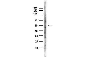 Western blot analysis of lysates from 293 cells(UV,30 min treatment), using Factor X Antibody at 1/1000 dilution.