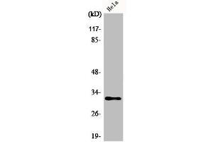 Western Blot analysis of Jurkat cells using AIG-1 Polyclonal Antibody (AIG1 抗体  (C-Term))