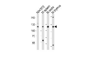 Western blot analysis of lysates from mouse NIH/3T3 cell line, mouse spleen, mouse testis, mouse thymus tissue lysate (from left to right), using Trim24 Antibody (C-term) (ABIN6244019 and ABIN6577664).