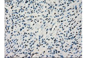 Immunohistochemistry (IHC) image for anti-Interferon Regulatory Factor 3 (IRF3) antibody (ABIN1498899)