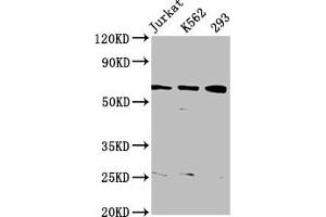 Western Blot Positive WB detected in: Jurkat whole cell lysate, K562 whole cell lysate, 293 whole cell lysate All lanes: ELP3 antibody at 3. (ELP3/KAT9 抗体  (AA 1-85))
