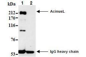 Western Blotting (WB) image for anti-Apoptotic Chromatin Condensation Inducer 1 (ACIN1) (AA 1-523), (N-Term) antibody (ABIN1105223) (ACIN1 抗体  (N-Term))