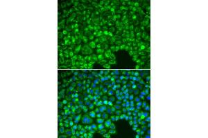 Immunofluorescence analysis of HeLa cells using NFKBIA antibody (ABIN5998337). (NFKBIA 抗体)