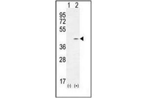 Western blot analysis of PTK9L (arrow) using PTK9L Antibody (N-term) Cat.