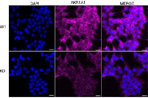 Immunocytochemical staining of HeLa cells using AKR1A1 antibody (ABIN7797569), 1:1,000), Top panel: wild-type (WT), Bottom panal: AKR1A1 shRNA knockdown (KD).