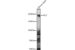 Western Blotting (WB) image for anti-Tet Methylcytosine Dioxygenase 2 (TET2) (AA 1833-2002) antibody (ABIN1513598)