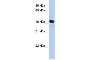 WB Suggested Anti-HSD11B2 Antibody Titration:  0. (HSD11B2 抗体  (N-Term))