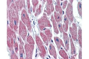 Immunohistochemistry (IHC) image for anti-Wingless-Type MMTV Integration Site Family, Member 10B (WNT10B) (Middle Region) antibody (ABIN2776702)