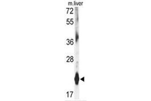 Western blot analysis of DHFR antibody (C-term) in mouse liver tissue lysates (35ug/lane). (Dihydrofolate Reductase 抗体  (C-Term))