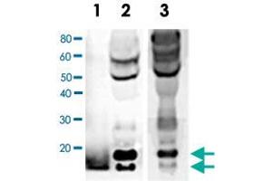 Western blot analysis of BDNF expression in human serum. (BDNF 抗体)