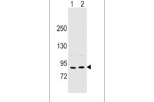Western blot analysis in MCF-7(lane 1),A375(lane 2) cell line lysates (35ug/lane). (Periostin 抗体  (C-Term))