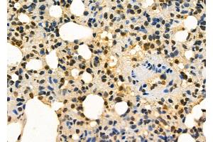 ABIN6256893 and ABIN6275972 at 1/100 staining Rat lung tissue by IHC-P.