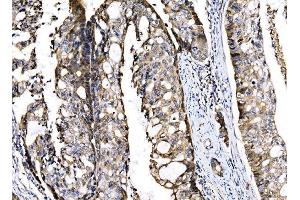 IHC analysis of Sigma1-Receptor/SIGMAR1 using anti-Sigma1-Receptor/SIGMAR1 antibody (ABIN7599011).