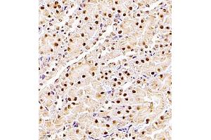 Immunohistochemistry of paraffin embedded rat kidney using ZHX3 (ABIN7076287) at dilution of 1:700 (400x lens) (ZHX3 抗体)