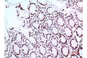 Immunohistochemistry (IHC) analysis of paraffin-embedded Human Colon, antibody was diluted at 1:100. (Tumor Protein p73 抗体  (Tyr221))