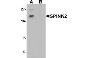 Western blot analysis of SPINK2 in mouse heart tissue lysate with SPINK2 Antibody  at 1 ug/mL in (A) the absence and (B) the presence of blocking peptide. (SPINK2 抗体  (C-Term))