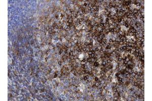 Image no. 1 for anti-Sex Determining Region Y (SRY) antibody (ABIN1501140) (SRY 抗体)