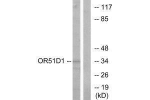 Western blot analysis of extracts from Jurkat cells, using OR51D1 antibody. (OR51D1 抗体  (Internal Region))