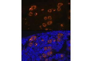 Immunofluorescence (IF) image for anti-Platelet Factor 4 (PF4) antibody (ABIN1683188)