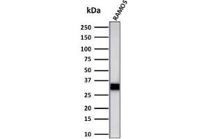 Western Blot Analysis of Ramos cell lysate using HLA-DR Mouse Monoclonal Antibody (LN-3 + HLA-DRB/1067). (HLA-DRB1 抗体)